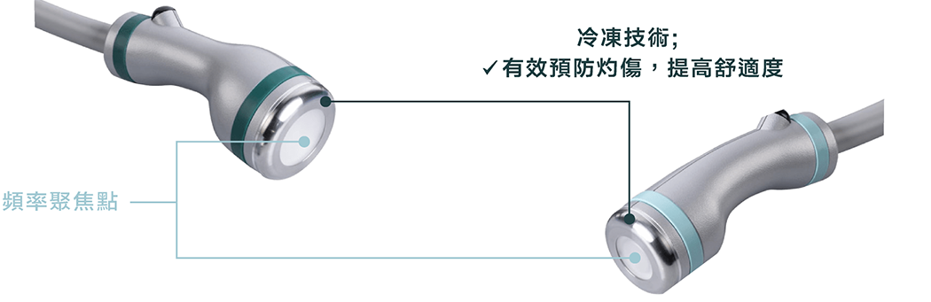 ONDA PLUS 手棒中間為頻率聚焦點，外圍以冷凍技術有效預防灼傷，提高舒適度。