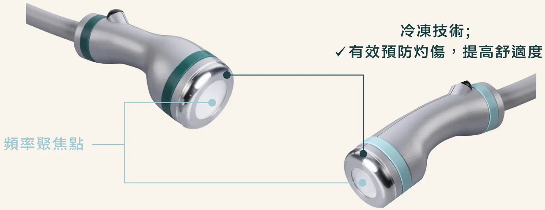 ONDA PLUS 手棒中間為頻率聚焦點，外圍以冷凍技術有效預防灼傷，提高舒適度。