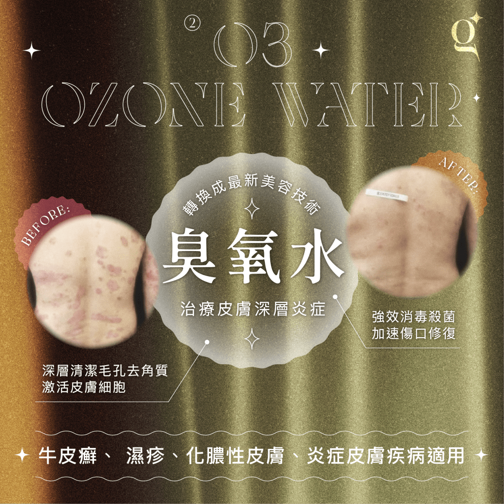 臭氧水具有強大的抗菌、抗炎功效，能夠減少炎症，並加速傷口修復癒合。適用於牛皮癬、濕疹、化膿性皮膚、炎症皮膚，幫助恢復肌膚屏障，舒緩痕癢、鎮靜降紅。
